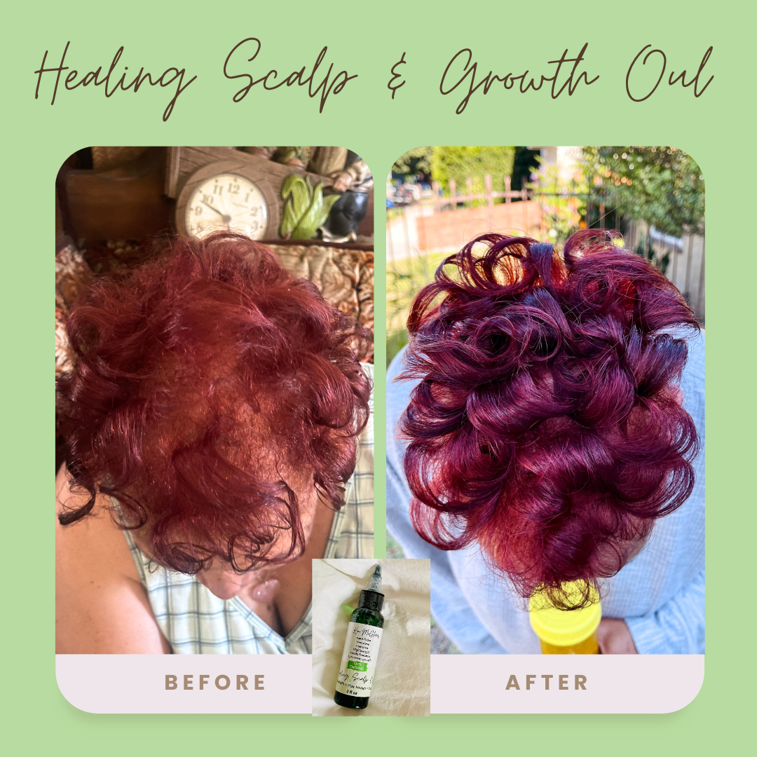 Organic Healing Scalp & Growth Oil